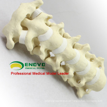 Ossos de simulação por atacado 12312 anatomia médica Artificial cervical, ortopedia prática osso de simulação